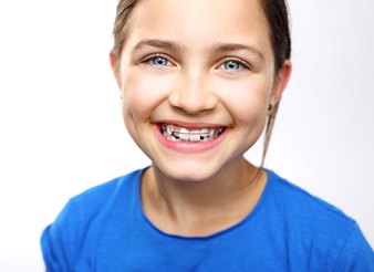 Little girl wearing orthodontic retainer